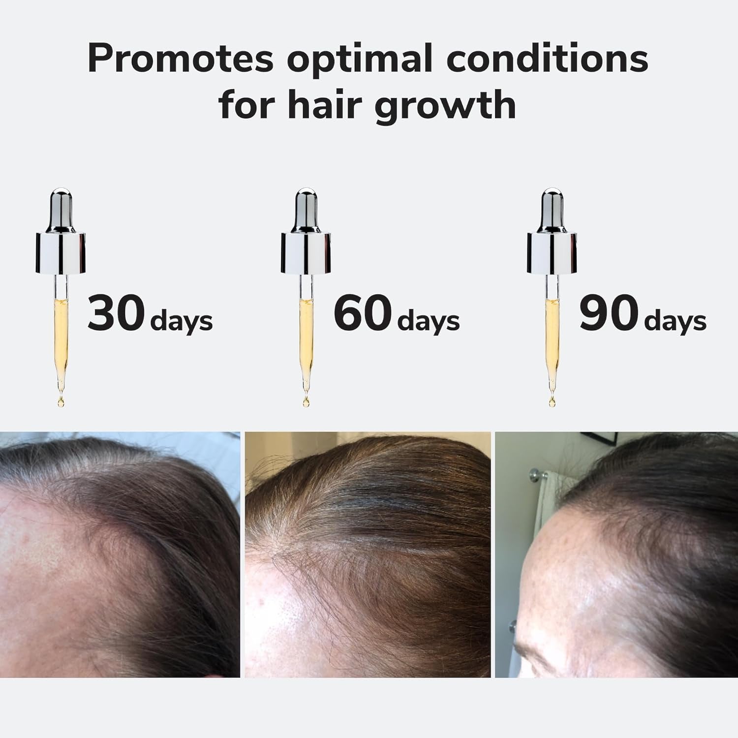 Youth Juice Collagen Scalp Treatment – Supports Scalp Collagen to Help Keep Hair Follicles Strong and Elastic | Creates Optimal Conditions for Growth + Stronger, Thicker, Glossy Hair