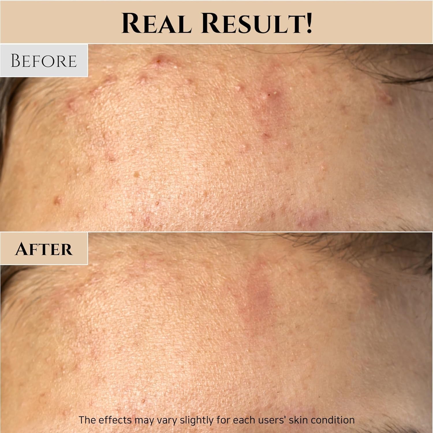 Ground Rice and Honey Glow Mask (150 Ml)