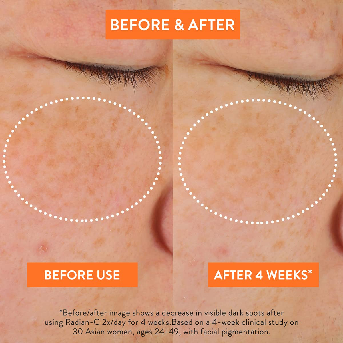 Radian-C Cream: Brightening Moisturizer with Vitamin C & E for Dark Spots, Dullness, & Radiant Skin, Hypoallergenic & Dermatologist-Tested