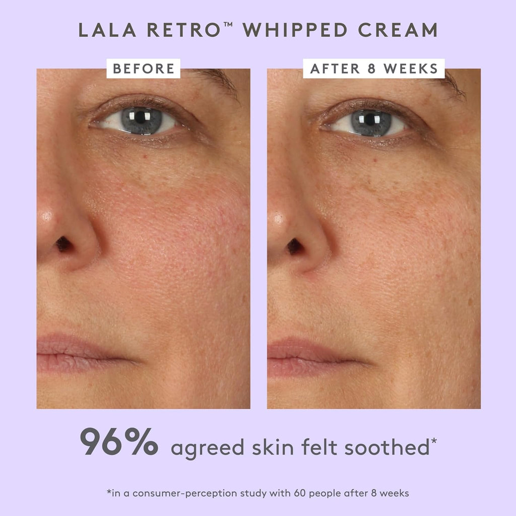 A-Shaba Complex Eye Serum with Deluxe Sample - 15Ml .1% Retinol Eye Cream - 5Ml Lala Retro Whipped Cream - Clean Clinical Skincare - Cruelty-Free - Dermatologist-Tested
