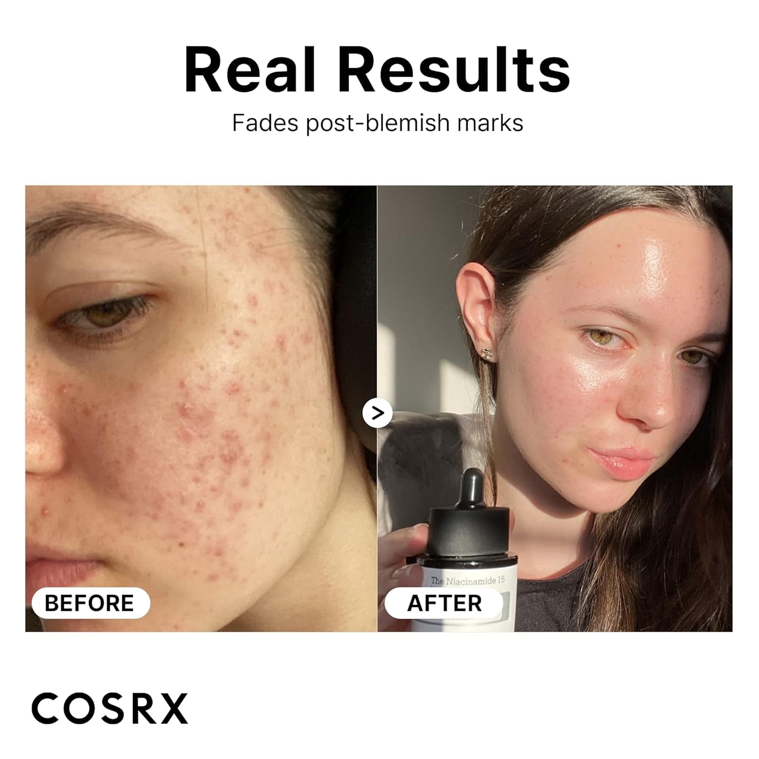 15% Niacinamide Face Serum, 0.67 Fl Oz, Pore Minimizer Serum for Face, Even Skin Tone, Korean Skin Care
