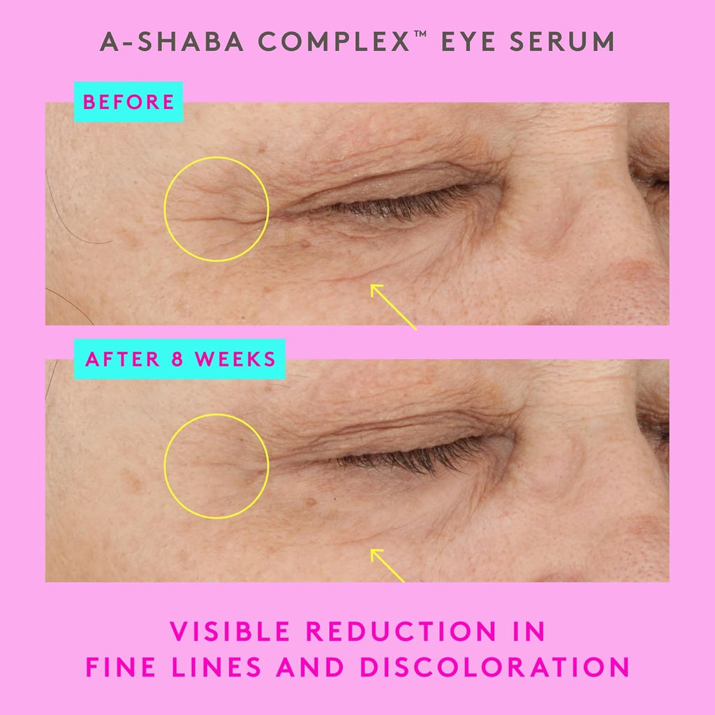 A-Shaba Complex Eye Serum with Deluxe Sample - 15Ml .1% Retinol Eye Cream - 5Ml Lala Retro Whipped Cream - Clean Clinical Skincare - Cruelty-Free - Dermatologist-Tested