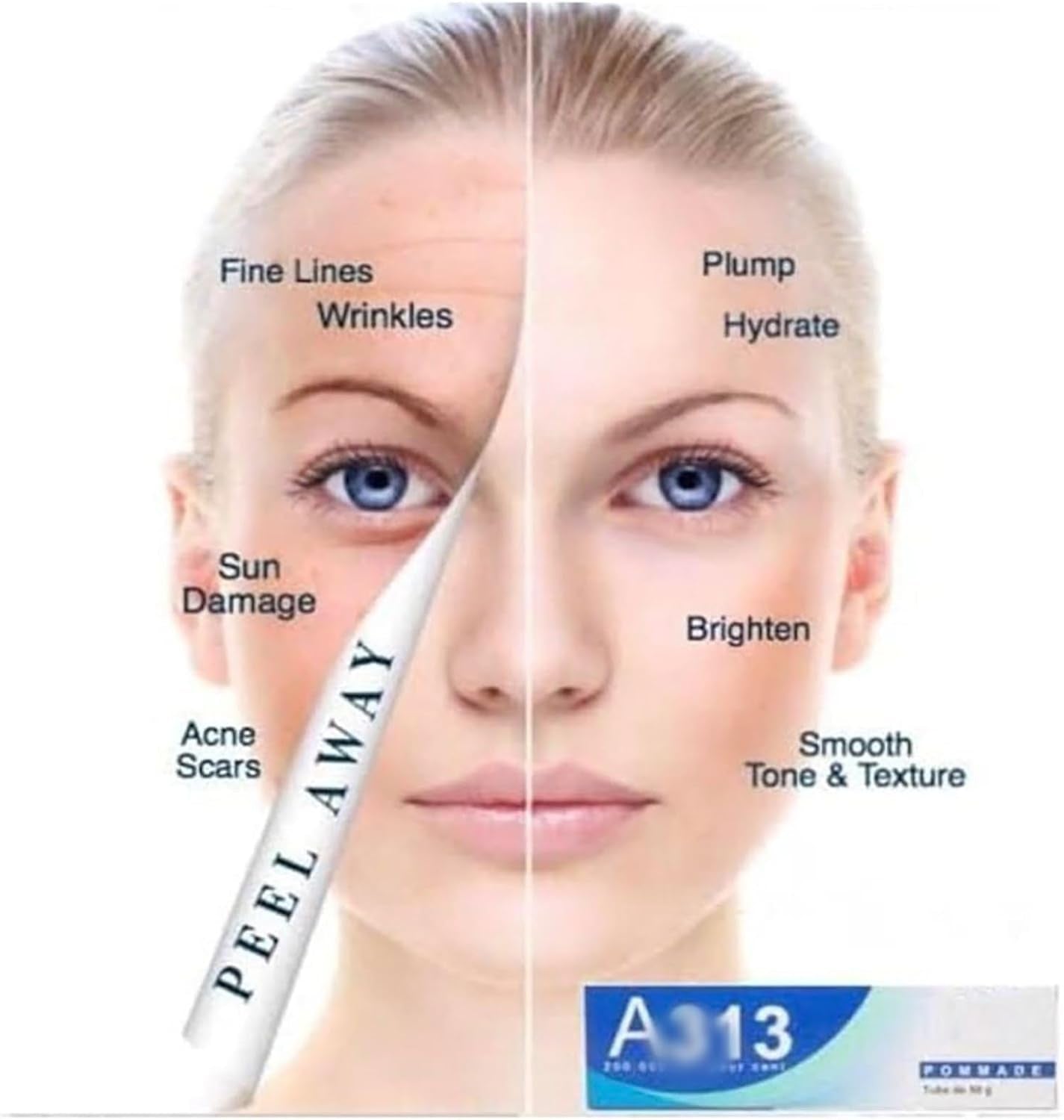 A~313 Vitamin a Retinol Cream, a Retinoids Lightweight 313 Face Cream for Anti-Aging, Reduce Wrinkles, Prevents Acne Breakouts, and Hyperpigmentation, Skincare for Smooth, Radiant Skin