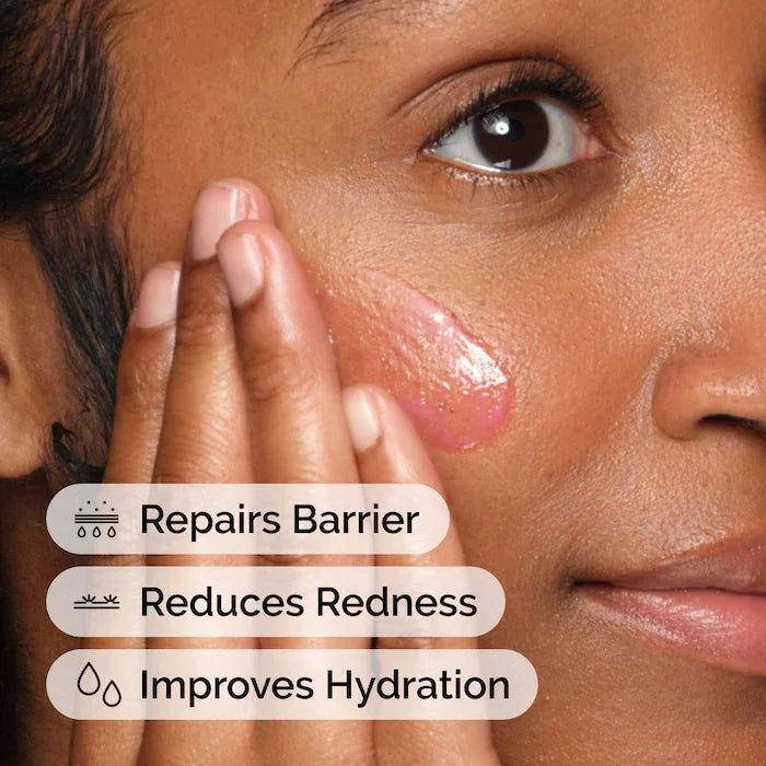 Soothing and Barrier Support Serum 30Ml Support Skin Barrier Repair Soothing Discomfort and Reducing the Look of Redness