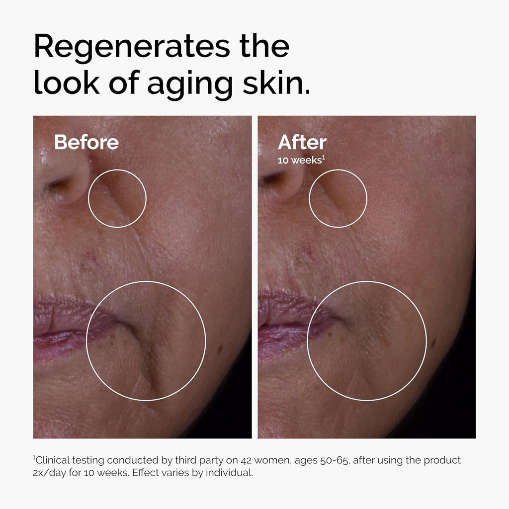 The Ordinary GF 15% Solution, Anti-Aging Formula for Visible Skin & Wrinkle Repair, 30Ml