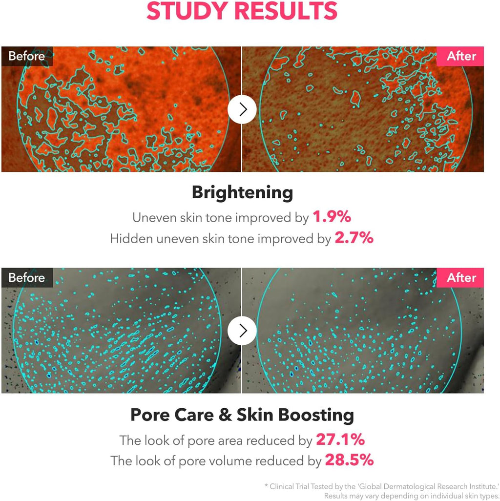 TXA Niacinamide Toning Shot 99 Spicule Facial Serum｜Skin Booster Serum for Brightening and Pore Care｜99% High-Purity Tranexamic Acid 3% + Niacinamide 5%｜Korean Skin Care｜1.01 Fl. Oz.