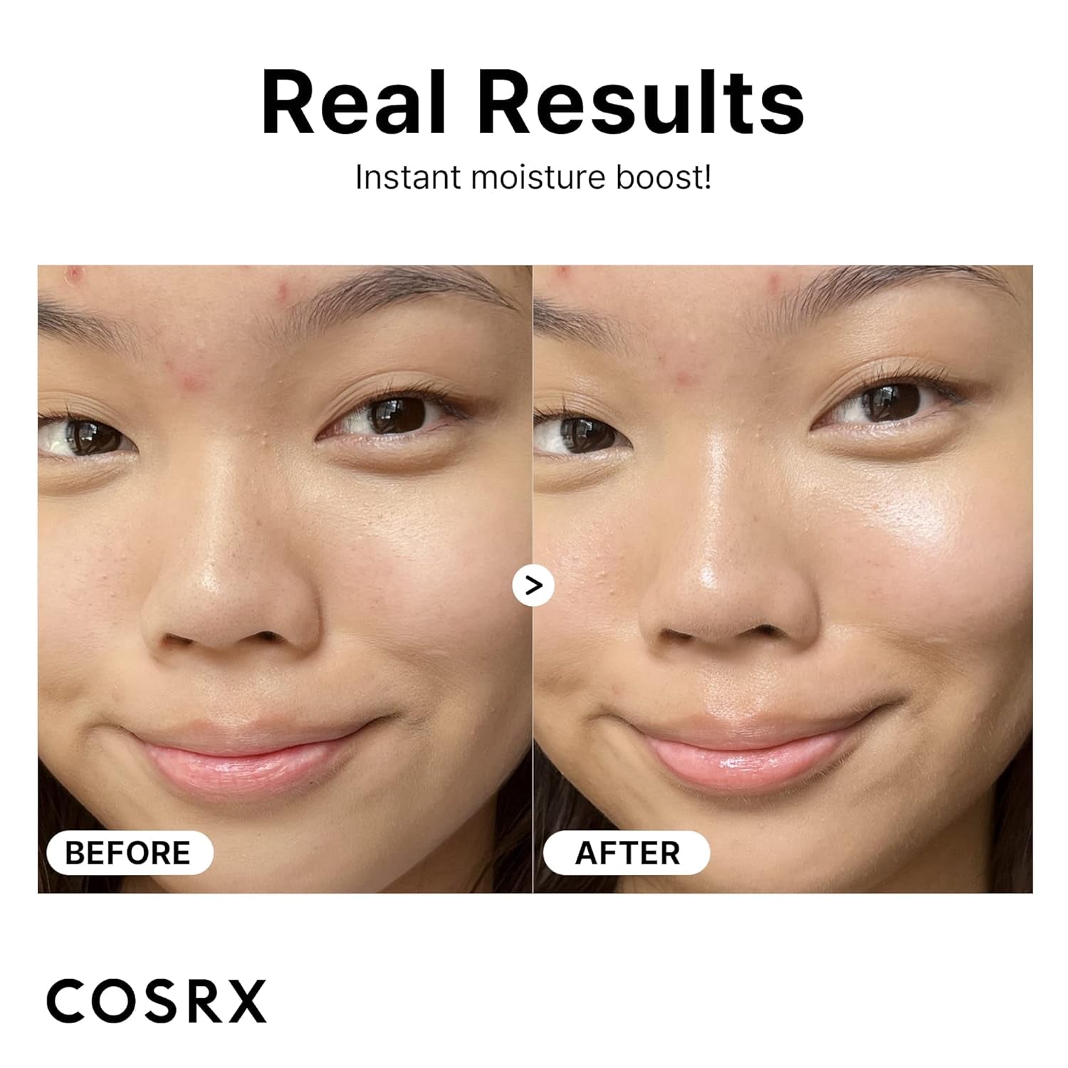 Pure Sodium Hyaluronic Acid 3% Serum, Hydration & Moisture Boosting Facial Serum for Fine Lines & Wrinkles, Plump & Repair Dry Skin, 0.67Fl.Oz/20Ml, No Artificial Fragrance, Korean Skin Care