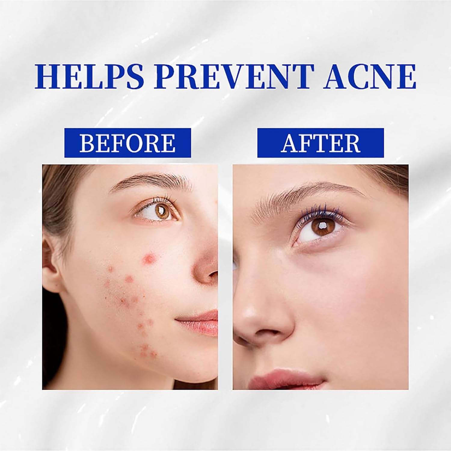 A~313 Vitamin a Retinol Cream, a Retinoids Lightweight 313 Face Cream for Anti-Aging, Reduce Wrinkles, Prevents Acne Breakouts, and Hyperpigmentation, Skincare for Smooth, Radiant Skin