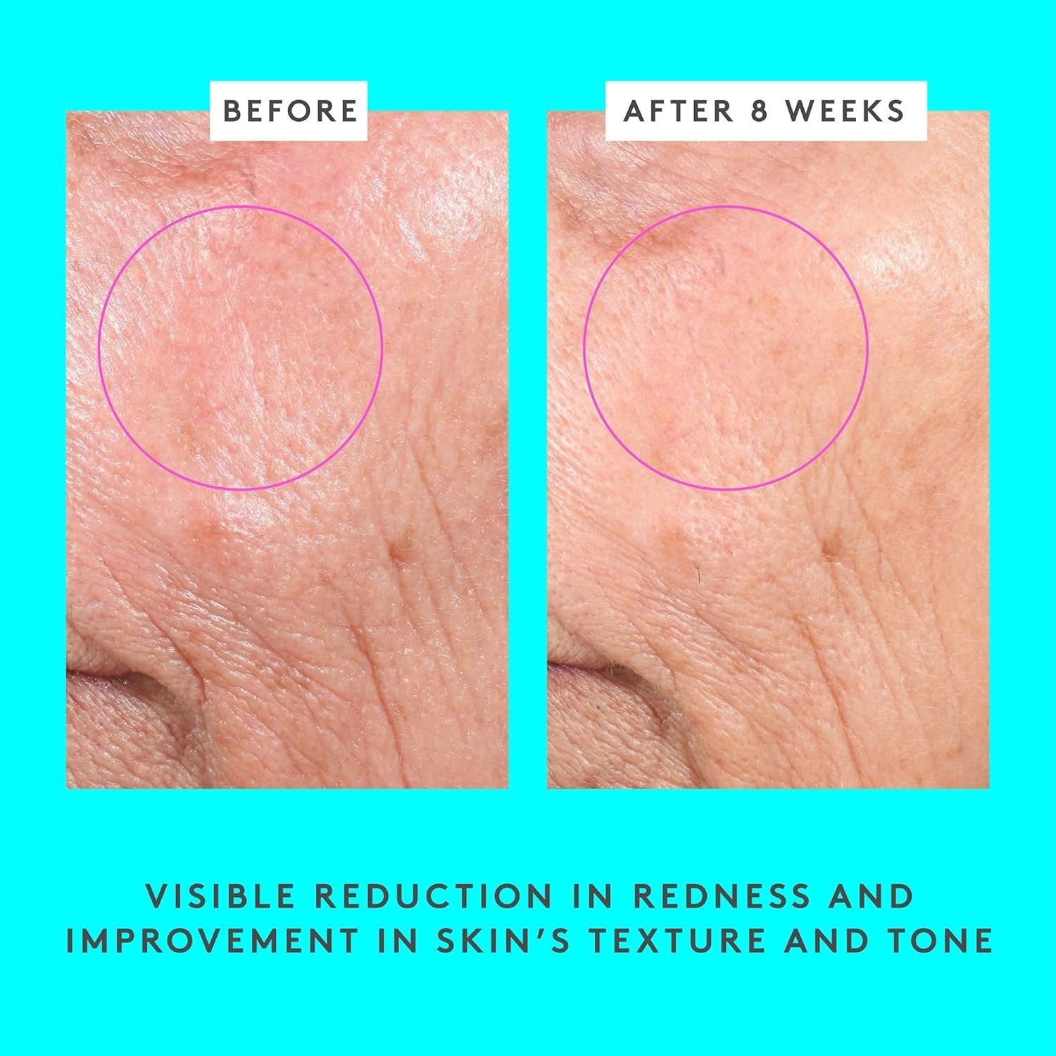 Bouncy Brightfacial - 50 Ml/1.69 Fl Oz - Illuminating Face Mask - Clean Clinical Skincare - Cruelty-Free - Dermatologist-Tested - Free of Essential Oils, Silicones, and Fragrance