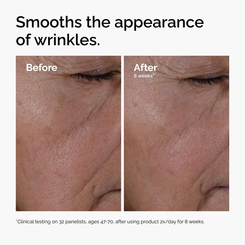 The Ordinary Multi-Peptide + HA, Anti-Aging Formula for Crow’S Feet, Elasticity & Firmness, 30Ml