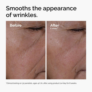 The Ordinary Multi-Peptide + HA, Anti-Aging Formula for Crow’S Feet, Elasticity & Firmness, 30Ml